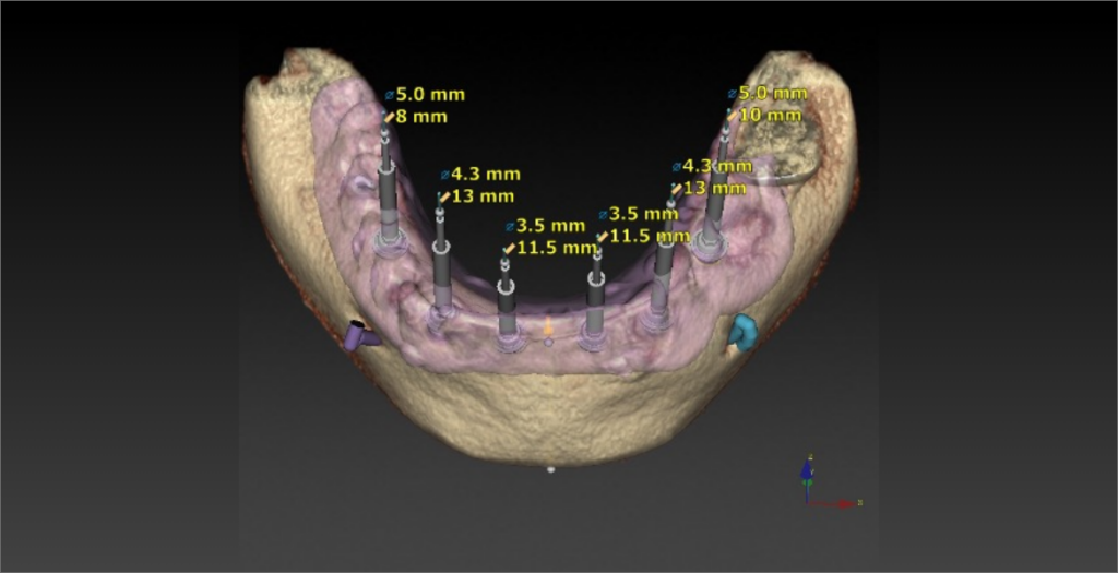 | periodontal and implant surgeons of houston