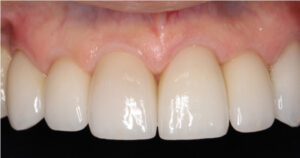 | periodontal and implant surgeons of houston