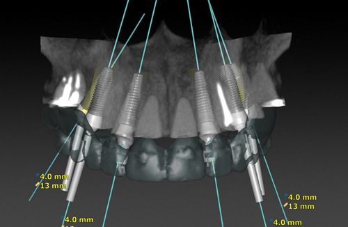 | periodontal and implant surgeons of houston