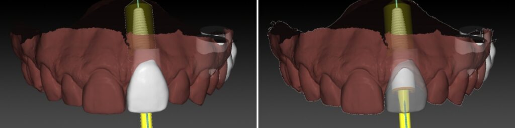 | periodontal and implant surgeons of houston