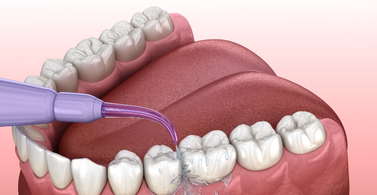 | periodontal and implant surgeons of houston