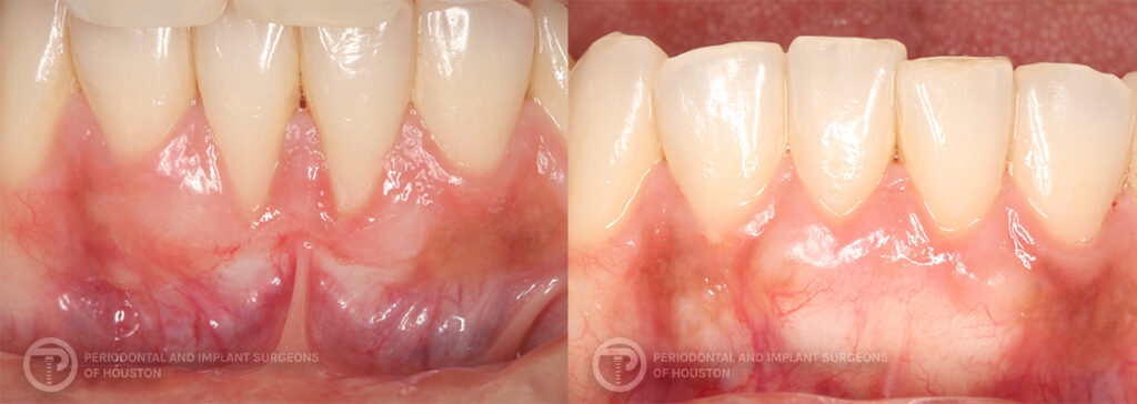 | periodontal and implant surgeons of houston