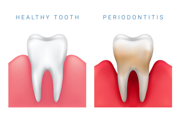 | periodontal and implant surgeons of houston