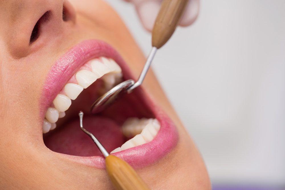 Why Choosing a Periodontist vs. General Dentist Matters for Implants